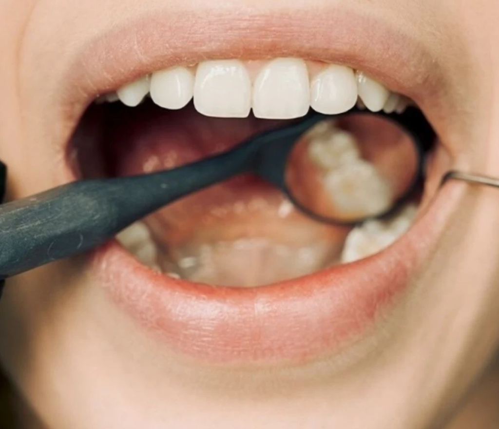 Tooth Regeneration Patch