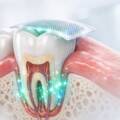 South Korean “Tooth Regeneration Patch” Claims vs. Scientific Reality