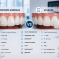 Composite Bonding vs Veneers: Which Smile Makeover Option Is Better in 2026?